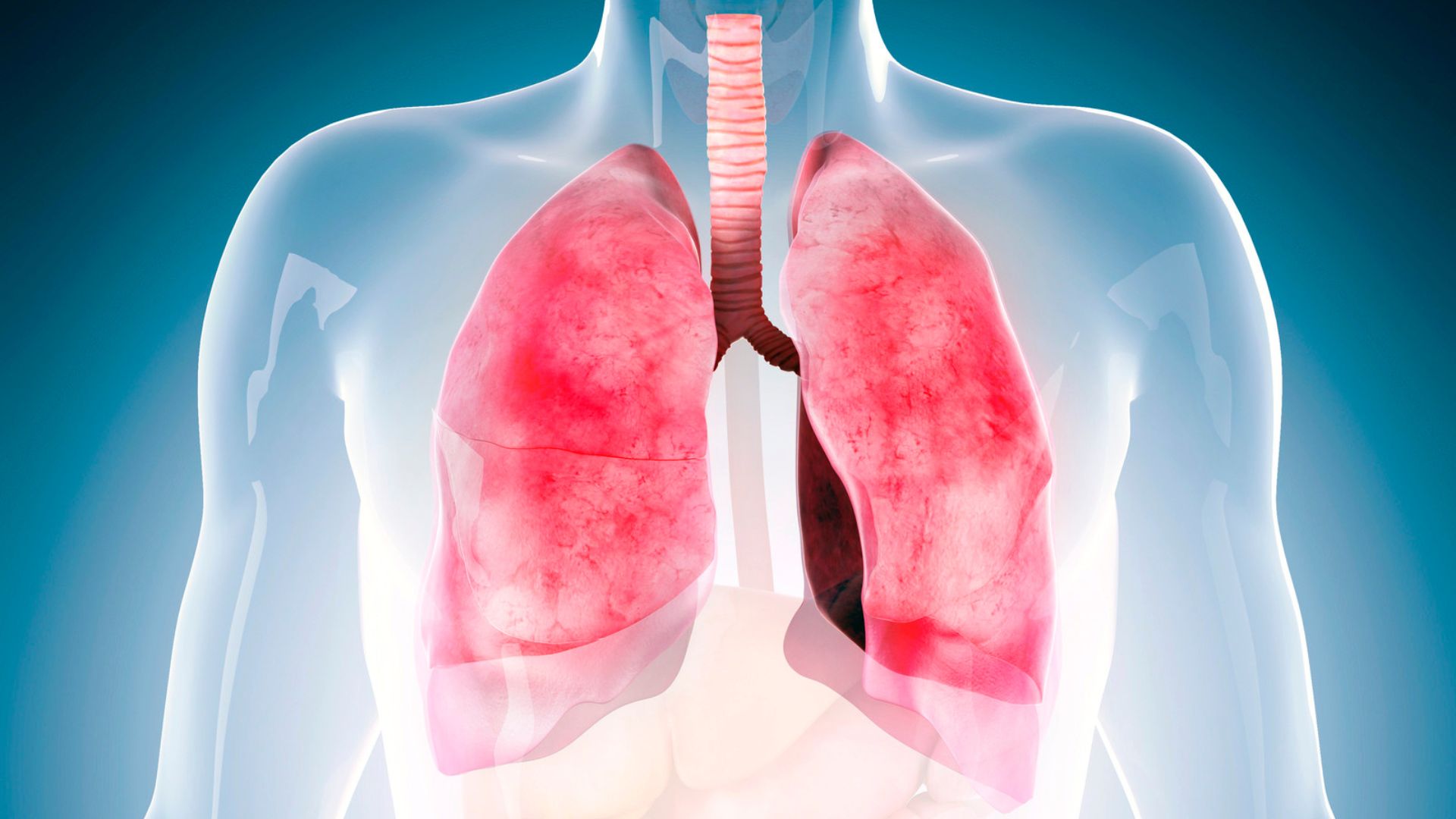 Choroby płuc – co musisz o nich wiedzieć?