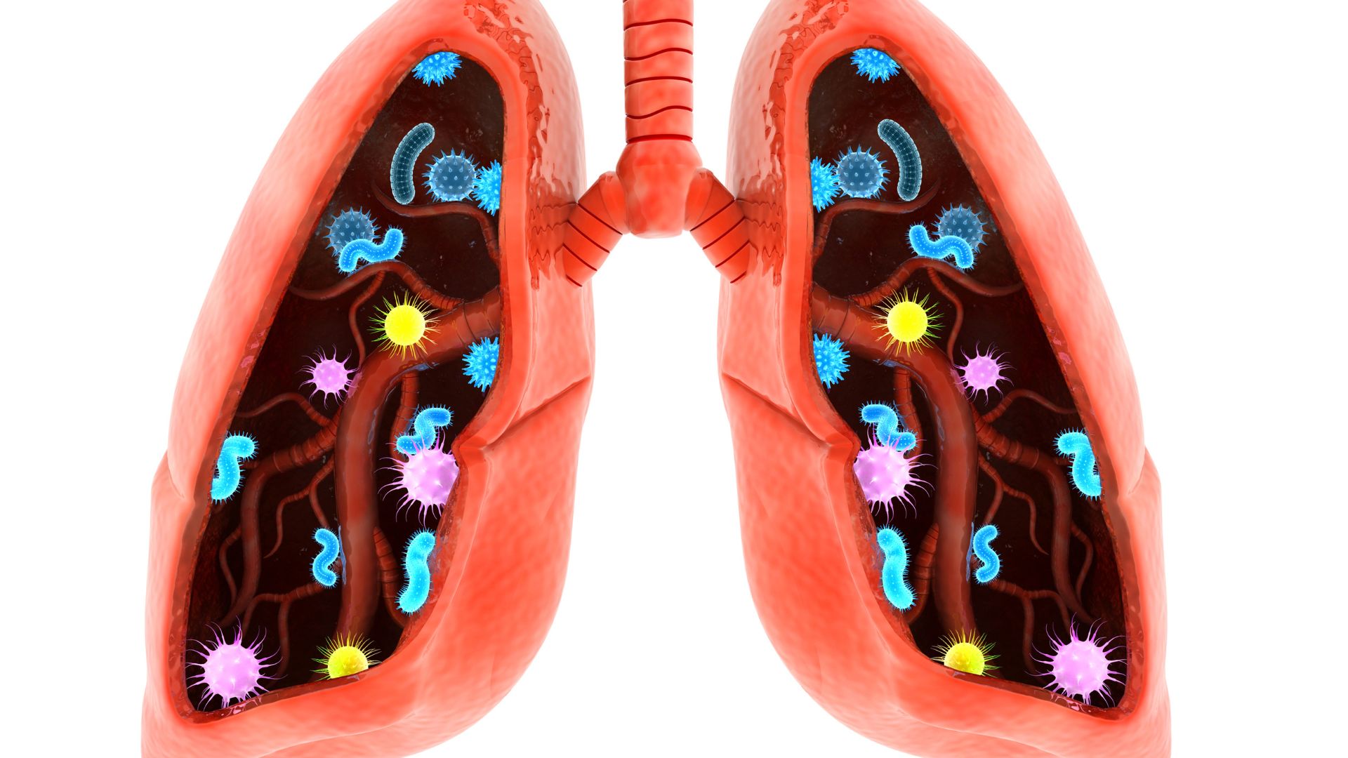 Czym charakteryzują się choroby śródmiąższowe płuc?