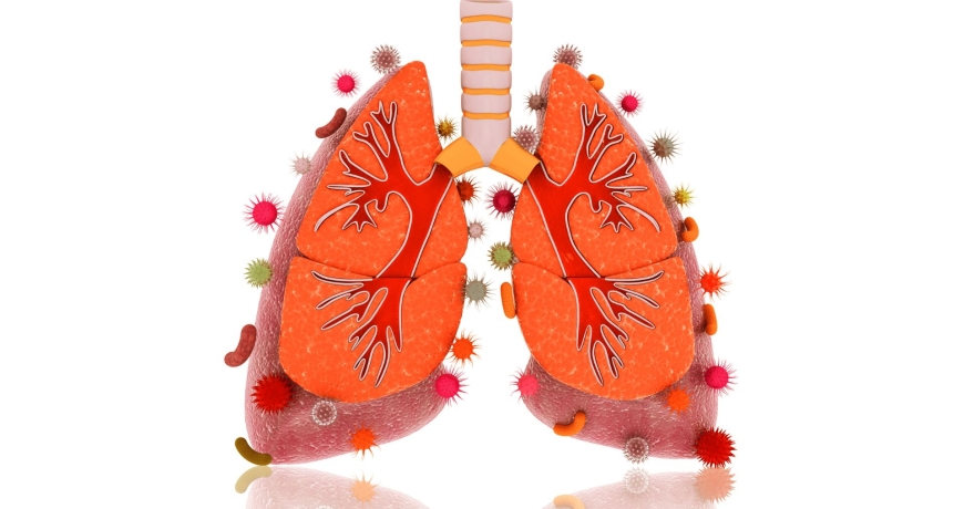 Cytomegalia płuc na wizualizacji graficznej.