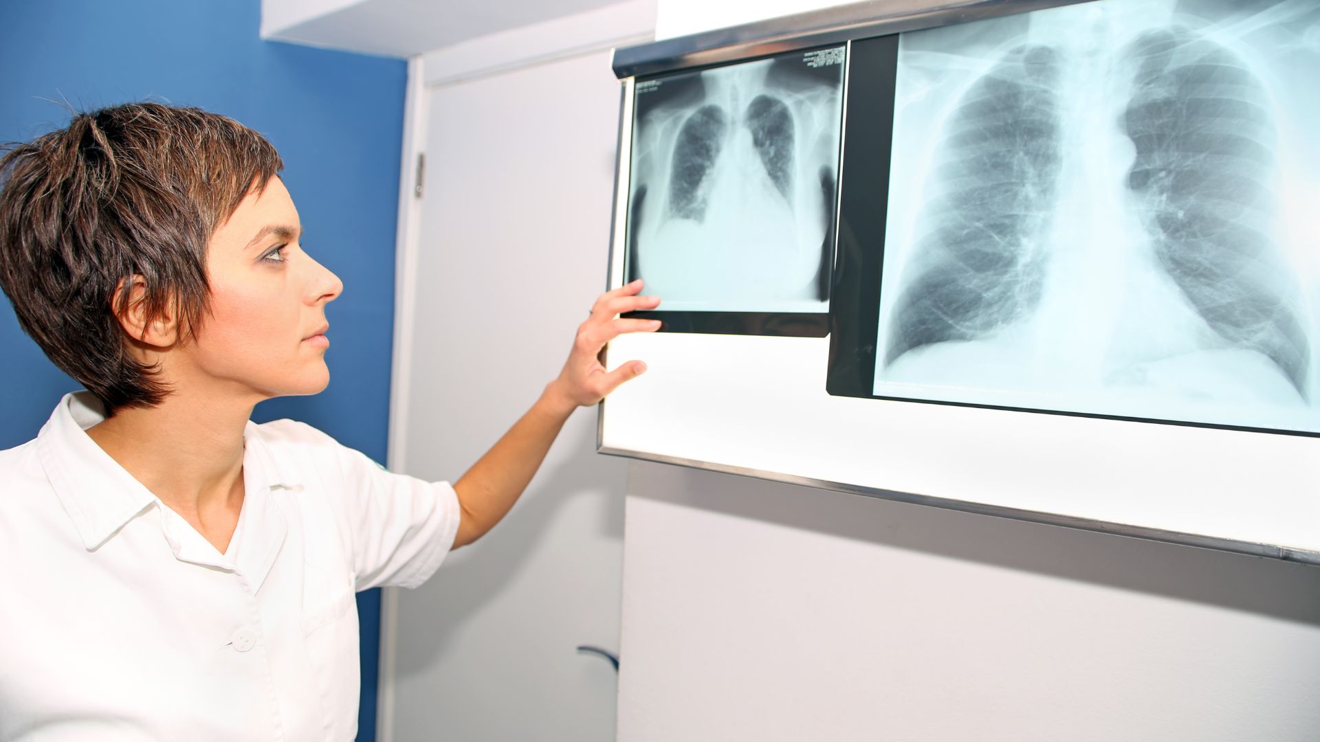 Czym jest zwłóknienie płuc i jak się objawia?
